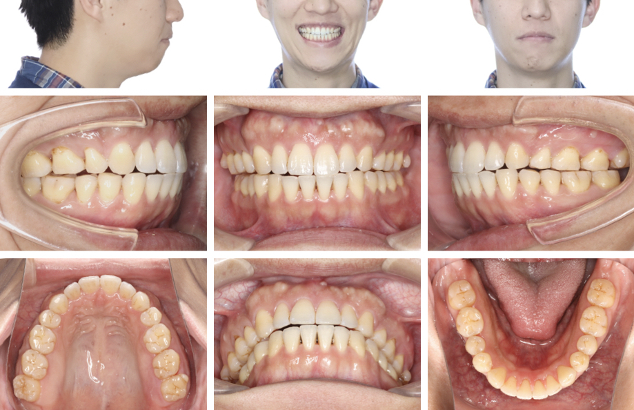 JOHNSTON new Vistas in Orhodontics 歯列矯正 JOHNSTON new Vistas in